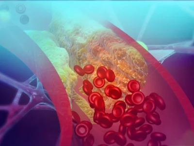 Advanced-Vascular-Therapy